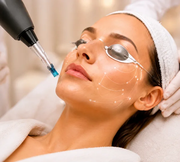 PicoSure Pro Laser